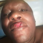 La campagne présidentielle vire à la violence physique dans la région du Nord du Cameroun. Le président régional du Social democratic front (Sdf) dans la région du Nord, Amadou Yaouba, « a violemment été agressé » avec ses camarades sur le chemin de son domicile le 5 octobre 2025 par des personnes dont l’identité n’a pas été dévoilée.