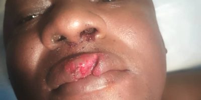 La campagne présidentielle vire à la violence physique dans la région du Nord du Cameroun. Le président régional du Social democratic front (Sdf) dans la région du Nord, Amadou Yaouba, « a violemment été agressé » avec ses camarades sur le chemin de son domicile le 5 octobre 2025 par des personnes dont l’identité n’a pas été dévoilée.