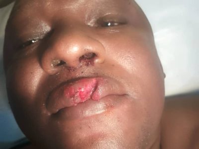 La campagne présidentielle vire à la violence physique dans la région du Nord du Cameroun. Le président régional du Social democratic front (Sdf) dans la région du Nord, Amadou Yaouba, « a violemment été agressé » avec ses camarades sur le chemin de son domicile le 5 octobre 2025 par des personnes dont l’identité n’a pas été dévoilée.