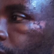 Thierry Eba president SPIC menace mort agression Minepat Alamine Ousmane Mey