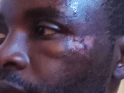 Thierry Eba president SPIC menace mort agression Minepat Alamine Ousmane Mey